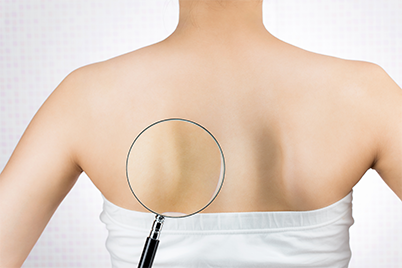 背中のストレッチとは？